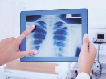 panacea centro diagnostico medico barranquilla radriografia digital